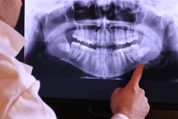 Best Emergency Dental Care for Broken or Chipped Teeth in Coson, OK