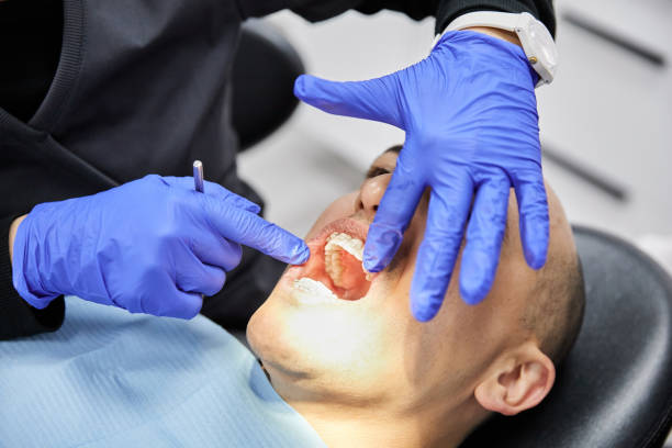 Best Emergency Dental Care for Broken or Chipped Teeth in Coson, OK