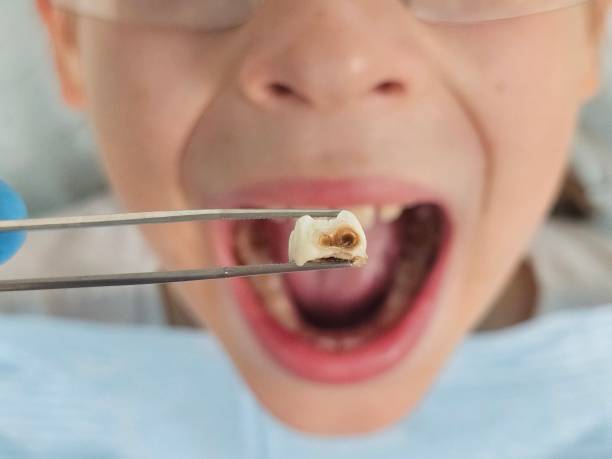 Best Emergency Gum Treatment in Coson, OK