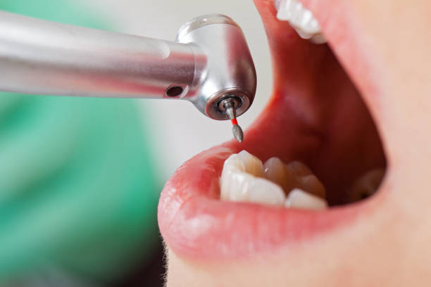 Best Pediatric Emergency Dentist in Coson, OK
